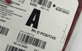 krew-podczas-porodu-ile-tracimy-i-kiedy-to-moze-byc-niebezpieczne